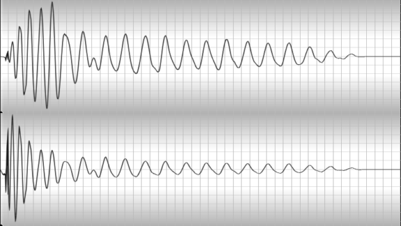 Transienten in einfachen Worten (mit Hörbeispielen)